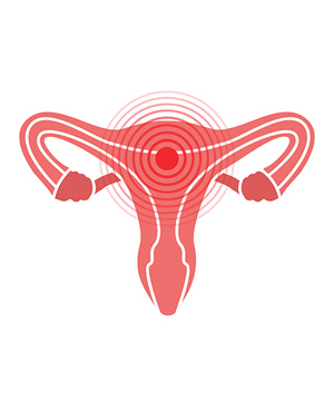 Painful intercourse at Evolve Gynecology Located in Las Vegas, NV
